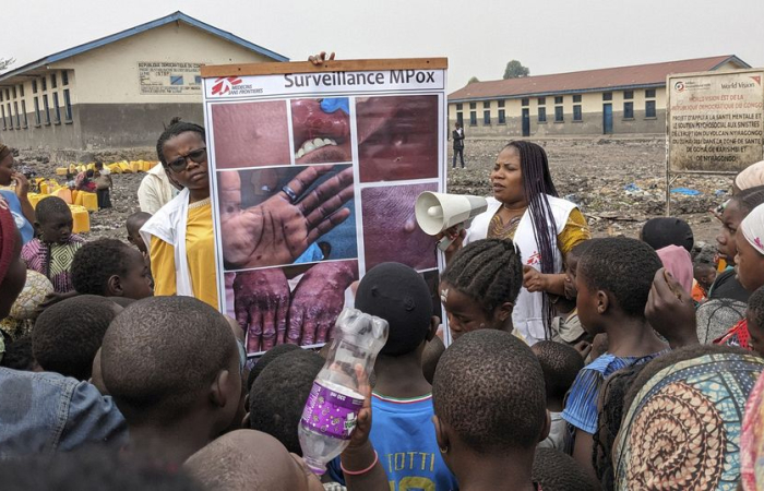 DR Congo faces severe shortages as Mpox spreads