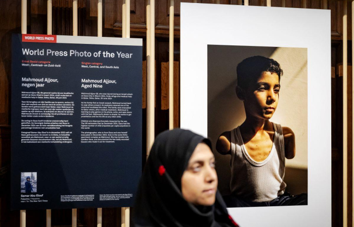 Amputee Palestinian boy image wins World Press Photo award