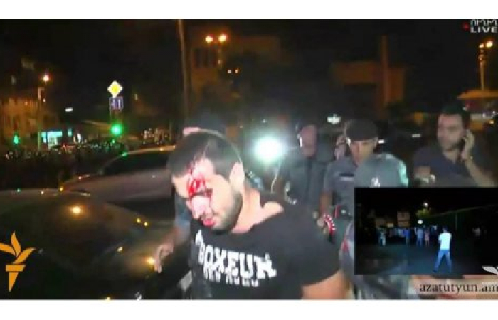 60 persons hospitalised, dozens arrested following police crackdown in Armenia